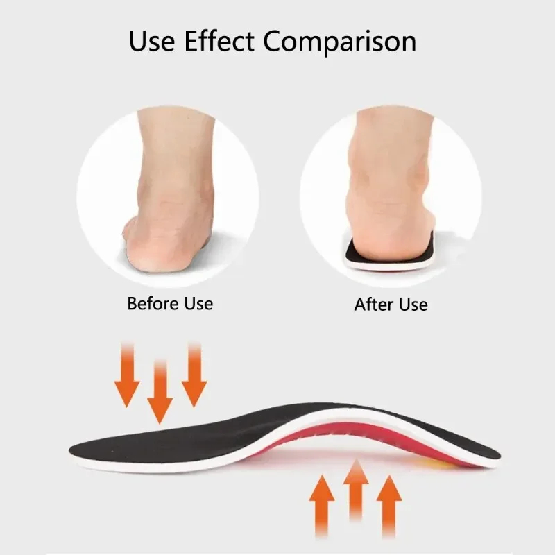 EVA 정형외과용 신발 깔창 남성용 평발 아치 지지대, - Men'S Shoes For Plantar Fasciitis 리뷰 및 가격